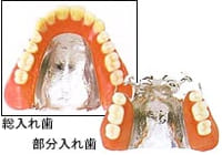 金属床（コバルト）