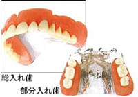 金属床（チタン）