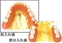 金属床（ゴールド）