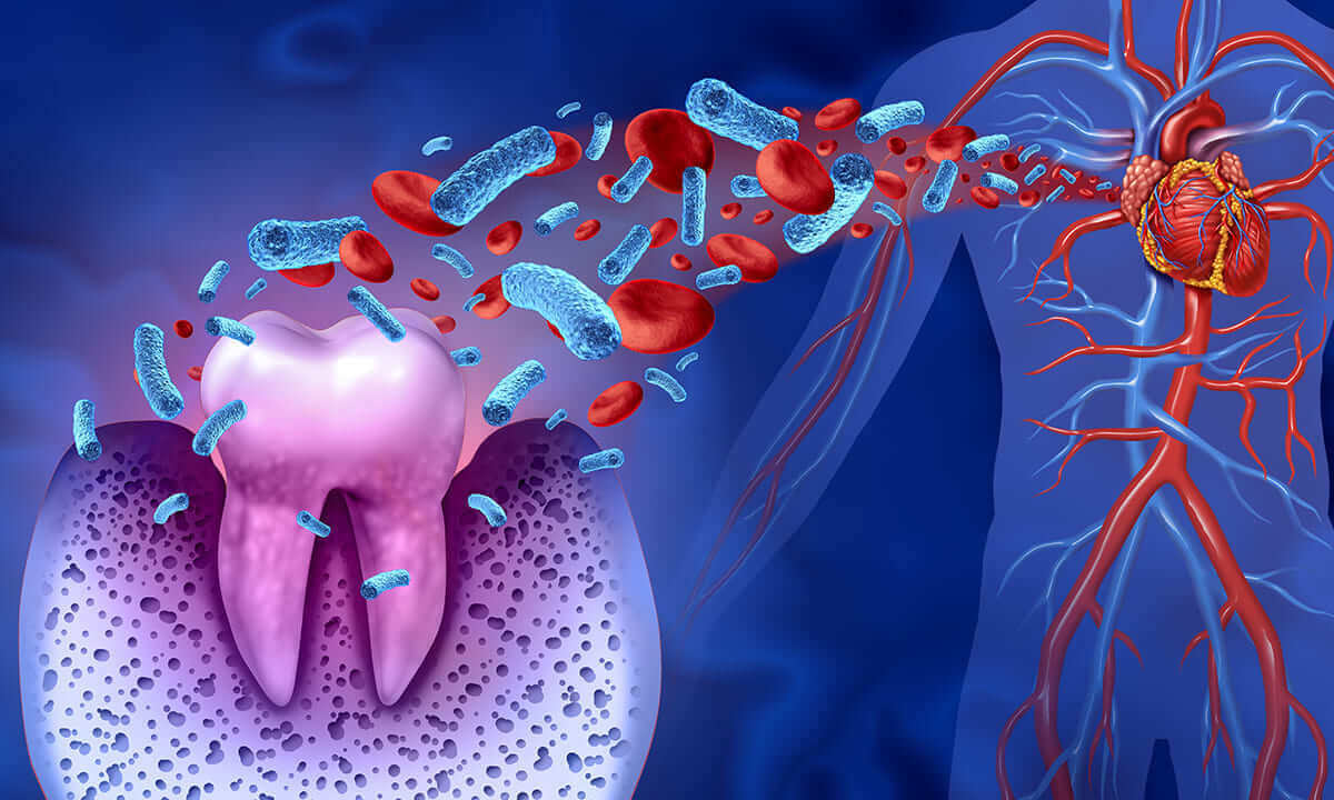 歯周病が全身に及ぼす影響