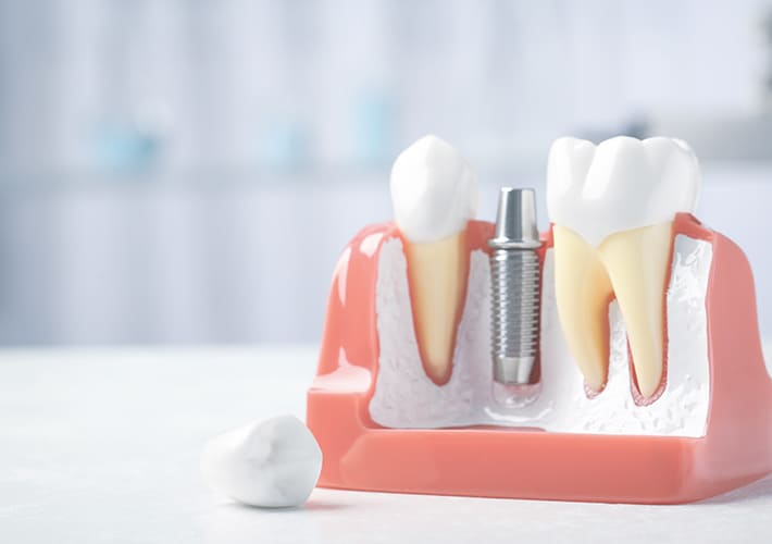 さいのき歯科｜先進的な機器で治療を行なう東住吉・針中野駅徒歩